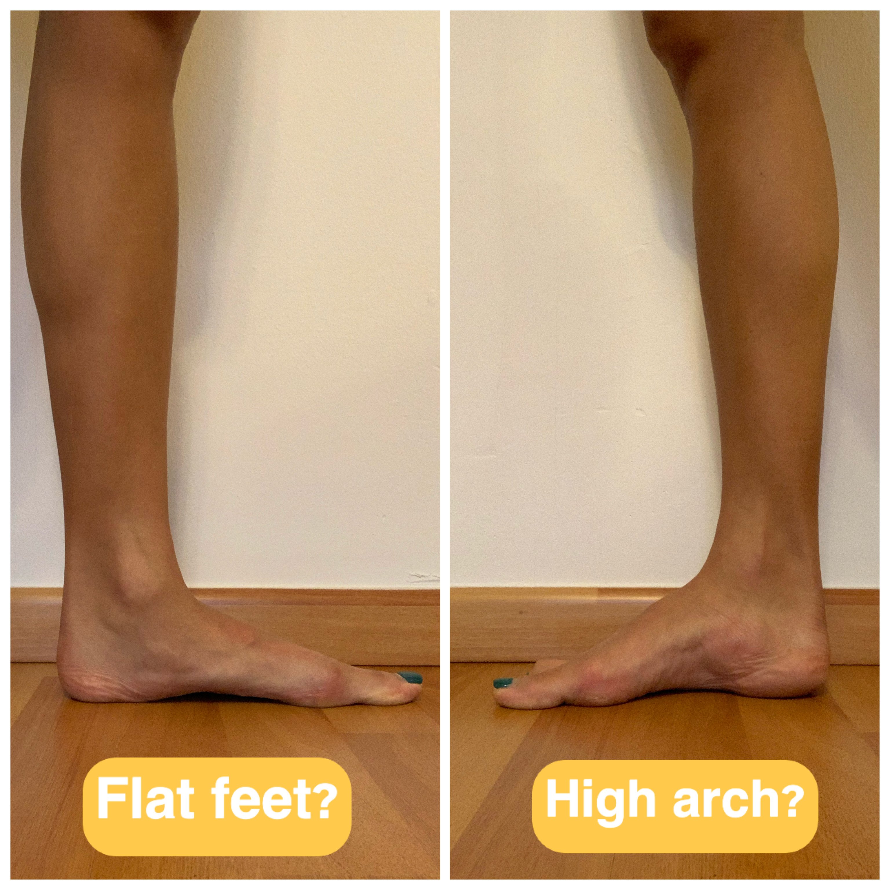 Flat Feet Vs High Arch ?width=4608&name=Flat Feet Vs High Arch 